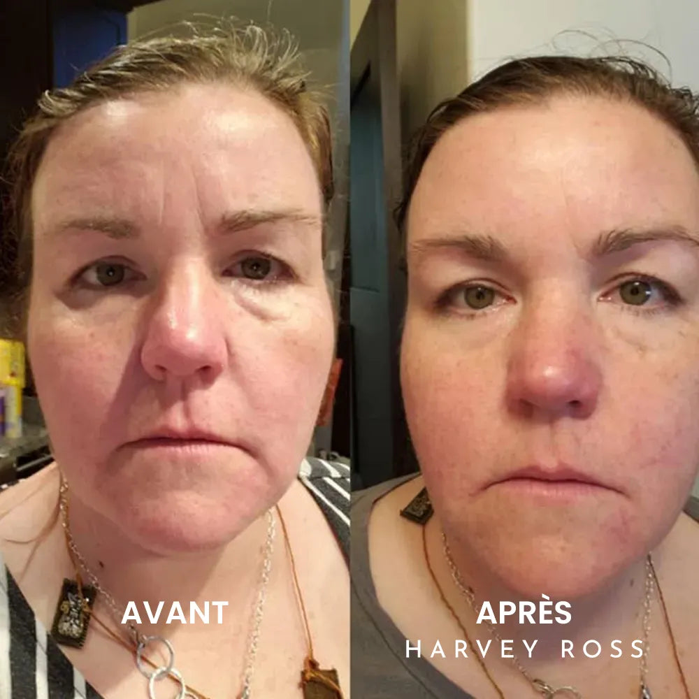 Harvey Ross - Instant Lift+