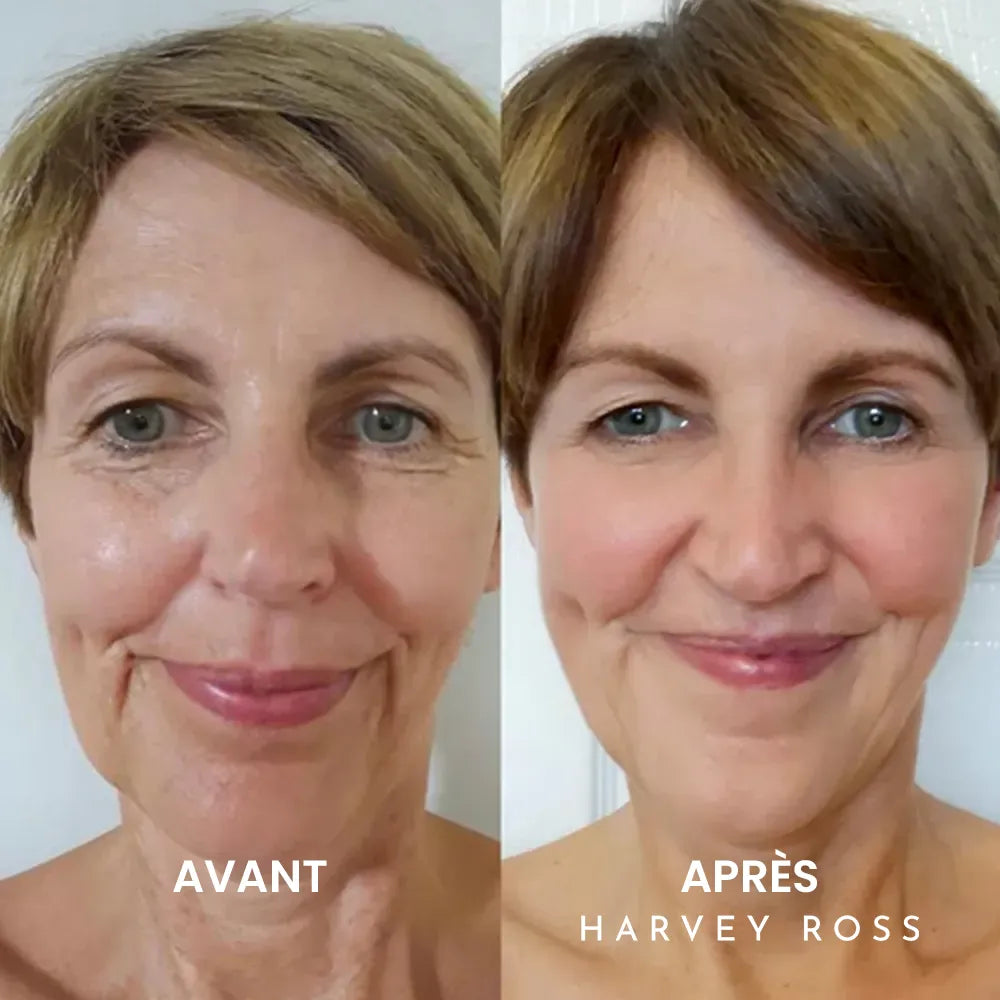 Harvey Ross - Instant Lift+